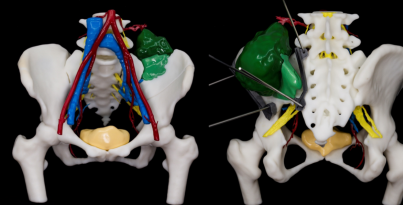 最快仅需20分钟，，，，，，，，解密“华西造”智能3D医疗高速打印系统